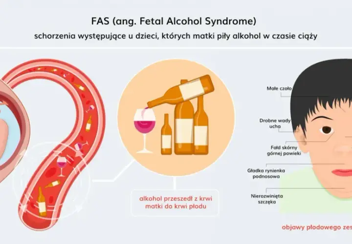 Ilustracja pokazuje płód w łonie matki, butelki alkoholu i dziecko z cechami FAS. Alkohol przechodzi z krwi matki do krwi płodu, powodując alkoholowy zespół płodowy.